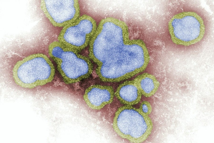 Post: Influenza Viruses