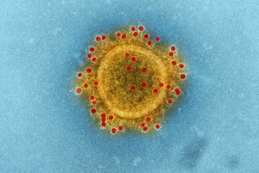 Post: Coronavirus